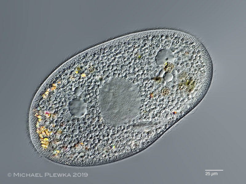 Freshwater and other micro-organisms from Germany: Paramecium bursaria ...