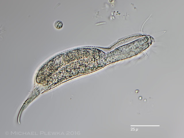 Limnic and other micro-organisms from Germany: Aspidiphorus silvaticus ...