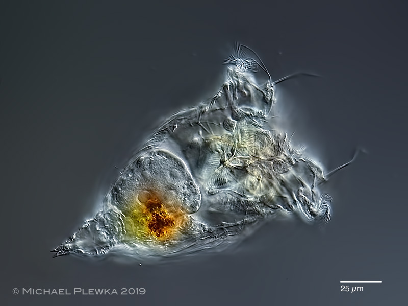 Some Microscopicorganisms Of The Nsg 